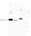 NAPD-ME | NADP-malic enzyme, chloroplastic (dicots)